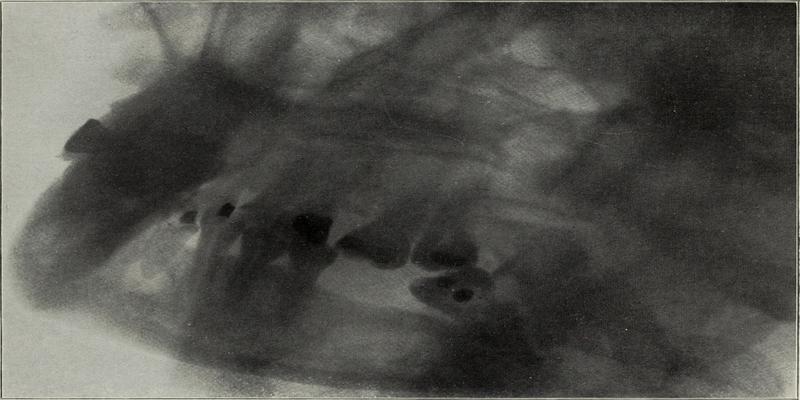 emergency dental near me